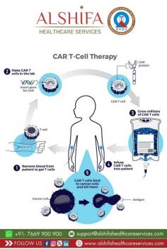  CAR T cell therapy is an innovative cancer treatment that modifies a patient's immune cells to recognize and attack cancer. This personalized therapy has shown remarkable success in certain blood cancers, offering new hope to patients. However, it can also cause side effects that require careful management. Ongoing research aims to expand its use to other cancer types.