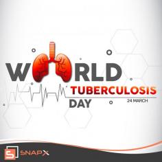 Raise Awareness: World Tuberculosis Day Tribute with SnapX

Commemorate World Tuberculosis Day with reverence and advocacy using SnapX's exclusive collection of World Tuberculosis Day Images, available for free download. Whether for your awareness campaigns, event promotions, or educational materials, these images serve as powerful tools to spread the message of prevention and care. Customize them effortlessly with our Festival Poster Maker, akin to the simplicity of Brands.live App, to amplify your impact in raising awareness and promoting health.

✓ Free for Commercial Use ✓ High-Quality Images.