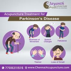 Acupuncture Treatment For Parkinson’s Disease in Chennai | Near Me.
Best Treatment For Parkinson's Disease in Chennai, Acupuncture is more effective in relieving PD. Tremor, Muscle Stiffness are symptoms