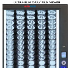  An ultra-slim X-ray film viewer is a medical device used for viewing X-ray films or radiographs.  Dot matrix backlight technology, the brightness area can be adjustable among 0 to 6000 cd/m2. Automatic sensing function