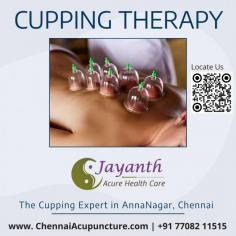Cupping Therapy in Chennai - Anna Nagar
Jayanth Acupuncture Provides Best Cupping Therapy in Anna Nagar, Chennai – combine cupping with acupuncture treatment to suit your health needs. We are the leading dry cupping expert in Chennai.