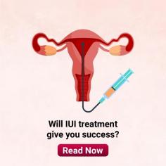 Intrauterine Insemination: IUI Treatment in Infertility at Indira IVF

Intrauterine insemination(IUI): Learn about the importance IUI treatment in infertility at Indira IVF. Get tips on what to do after IUI treatment. For more information, visit: https://www.indiraivf.com/infertility-treatment/intrauterine-insemination-iui-treatment