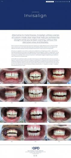 Invisalign consultation and assessment

