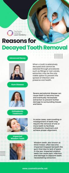 Decayed tooth removal is a common dental procedure performed to address severe decay, gum disease, impacted wisdom teeth, and other oral health issues. 

Source: https://cosmeticsmile1.wordpress.com/2024/05/17/decayed-tooth-removal-what-should-you-know/
