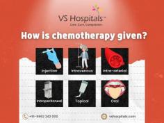 VS Hospital in Chennai is renowned for its comprehensive chemotherapy services, offering advanced cancer treatment with a patient-centric approach. The hospital is equipped with state-of-the-art facilities and a team of experienced oncologists who provide personalized care.