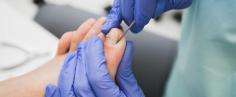 Ingrown Toenail Treatment | Removal of Ingrown Toenail

We understand the inconvenience and pain an ingrown toenail can cause. We provide ingrown toenail treatment or removal.