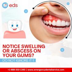 Gum Swelling or Abscess? | Emergency Dental Service

Don't overlook signs of swelling or abscess on your gums!  Emergency dental services are here to assist you. Ignoring dental issues can lead to complications, so act promptly and seek professional help. Your oral health matters! Schedule an appointment at 1-888-350-1340. 