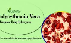 When it comes to navigating the use of Hydroxyurea Dose for Polycythemia Vera, it is important to understand potential side effects and complications. Common side effects include nausea, vomiting, diarrhea or constipation, headache, fatigue, and skin reactions. Rare but serious side effects can also occur such as liver injury or bone marrow suppression. It is important to discuss all potential risks with your doctor before starting treatment with hydroxyurea.
