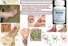 By Herbal Treatment for Osteomyelitis. it can control Pain in the area of infection Fever, Chills, Swelling, redness, Bone pain and other symptoms Following are some Natural Remedies for Osteomyelitis are given below.