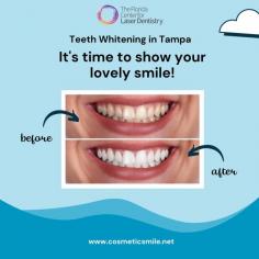 Achieve a brighter smile with expert teeth whitening in Tampa. Professional services ensure safe, effective results. Book your appointment today for dazzling teeth!

Visit: https://cosmeticsmile.net
