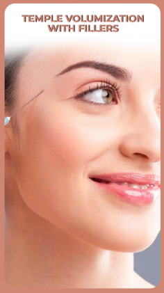 Restore youthful fullness to your temples with Temple Volumization with Fillers at Halcyon Medispa in London. Our skilled practitioners use advanced filler techniques to add volume and smooth the temple area, enhancing your natural beauty. Enjoy personalized care and effective results with our safe, non-surgical treatments. Achieve a rejuvenated look today at Halcyon Medispa.
