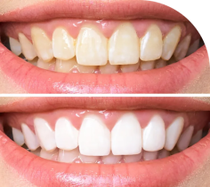 Enhance your smile with the best cosmetic dentist in Mumbai. Dr. Ashwadhi offers advanced cosmetic dental procedures for a perfect smile.
https://ashwadhidentalclinic.com/cosmetic-dentistry/