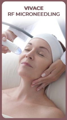 Want tighter, younger-looking skin in London?  Halcyon Medispa offers Vivace RF Microneedling! This treatment combines microneedling with radiofrequency energy to stimulate collagen production and tighten your skin. It's customizable for your needs and leaves you with a refreshed, glowing complexion – all with minimal discomfort and no downtime.


