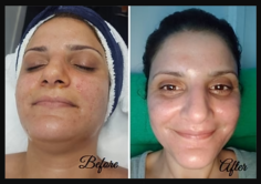 Laser Skin Resurfacing in Brisbane - LLC Cosmetic Laser Clinic

Transform your skin with laser skin resurfacing in Brisbane at LLC Cosmetic Laser Clinic. Our treatment reduces wrinkles, scars, and imperfections for a smoother complexion. Schedule today.

https://llccosmetic.com/cdn/shop/files/Before_860a8bd0-f66e-4771-9b7f-9f093426b346.png?v=1675228124

#LaserSkinResurfacing #BrisbaneBeauty #YouthfulSkin #LlcCosmetic #BrisbaneClinic