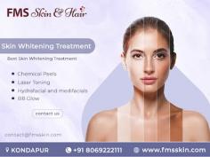 FMS Skin and Hair Clinics, offers a range of advanced skin whitening treatments to help achieve a brighter, more even complexion. Our expert dermatologists use the latest techniques and technologies to safely and effectively lighten skin tone, reduce pigmentation, and enhance overall skin radiance.

1. Topical Treatments
Medical-grade creams and serums containing ingredients such as hydroquinone, kojic acid, vitamin C, and retinoids. These formulations inhibit melanin production, exfoliate dead skin cells, and promote new cell growth.

2. Chemical Peels
Chemical peels involve applying a solution to the skin that causes controlled exfoliation. Depending on skin type, various peels are recommended which include glycolic acid, salicylic acid, and TCA peels, effectively treats hyperpigmentation and sun damage.

3. Laser Treatments
Advanced laser treatments target and break down excess melanin in the skin, reducing pigmentation and promoting a lighter skin tone. Fractional CO2 lasers, Q-switched lasers, and IPL (Intense Pulsed Light) therapy.

4. BB Glow
This innovative semi-permanent foundation treatment infuses nutrient-rich serums into the skin using microneedling technology. BB Glow instantly enhances skin tone & reduces pigmentation.

Know more on https://www.fmsskin.com/skin-whitening-treatment-in-hyderabad/

#SkinWhitening #SkinWhiteningTreatment