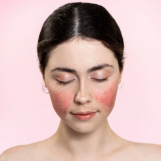 Advanced Laser Treatment for Rosacea - LLC Cosmetic Laser Clinic

Get advanced laser treatment for rosacea at LLC Cosmetic Laser Clinic. Our specialized lasers target and reduce rosacea symptoms, improving skin appearance. Book your appointment now.

https://llccosmetic.com/cdn/shop/files/laser_treatment_Rosacea_Treatment.jpg?v=1682590708&width=720

#RosaceaTreatment #LaserTherapy #ClearSkin #LlcCosmetic #BrisbaneClinic