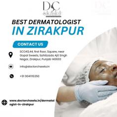People often face skin issues due to a bad environment or other reasons. If you are facing such a problem, you must visit Dr. Chawla’s Clinic, one of the best dermatologists in Zirakpur. We provide our customers with the best advice. Moreover, We use ultra-modern laser treatments for treating skin issues. For More Information visit our website at :- http://www.doctorchawla.in/dermatologist-in-zirakpur 
