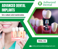 Reliable Solutions for Tooth Replacement

We transform your smile with expert dental implants for natural-looking, lasting results. Our approach ensures effective restoration with personalized care for every patient's smile. For more information, mail us at emily.ashwooddental@gmail.com.