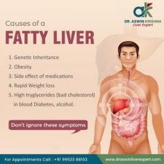 Dr. Aswin Krishna is a renowned specialist in Chennai for treating fatty liver disease. With extensive expertise in hepatology, he offers personalized treatment plans tailored to each patient's needs. Dr. Krishna employs advanced diagnostic techniques and therapeutic interventions to manage fatty liver conditions effectively, focusing on lifestyle modifications and medication when necessary. Patients benefit from his compassionate care and commitment to improving liver health outcomes in Chennai.For more Details please visit https://draswinkrishna.com/fatty-liver-specialist-in-chennai/