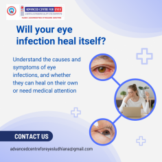 Understand the causes and symptoms of eye infections, and whether they can heal on their own or need medical attention



