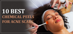 Looking for the best chemical peels for acne scars in London? Halcyon Medispa provides effective solutions to clear and smooth your skin. Find out more about our top treatments.