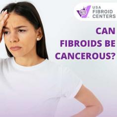 Get the Facts About: Are Fibroids Cancerous
Are you concerned about the possibility of fibroids being cancerous? While most fibroids are benign, some symptoms can be worrying. At USA Fibroid Centers, we prioritize your health by offering expert care and advanced diagnostic tools to assess and treat fibroids effectively. Our specialized team is here to address your concerns and provide personalized treatment options tailored to your needs. Don’t let fear hold you back—our experienced doctors are ready to help you take control of your health. If you're asking, "Are fibroids cancerous?"—we have the answers and solutions you need. Visit us today to learn more about how we can help you.
Visit- https://www.usafibroidcenters.com/uterine-fibroids/fibroid-cancer/ 

