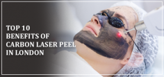 Enjoy the benefits of Carbon Laser Peel in 2024 with minimal downtime. This quick and minimally invasive procedure provides deep cleansing, exfoliation, and collagen boosting, suitable for all skin types. Achieve a smoother, more radiant complexion with reduced acne and minimized pores.