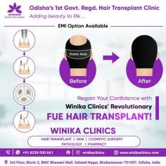 Struggling with hair loss? Winika Clinics, Odisha’s first government-registered hair transplant clinic, offers the cutting-edge FUE hair transplant. This minimally invasive procedure provides natural-looking results with minimal downtime, ensuring a fuller, healthier head of hair.

See more: https://www.winikaclinics.com/follicular-unit-extraction-fue
