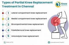 Knee joint replacement in Chennai involves replacing the damaged knee joint with an artificial implant to relieve pain and restore function. Total knee replacement is a common procedure for those with severe arthritis or injury. The surgery is performed by skilled orthopedic surgeons using advanced techniques, ensuring precise alignment and long-lasting results. Recovery includes personalized rehabilitation to regain strength and mobility, allowing patients to return to daily activities with improved quality of life.  For more details visit https://kneereplacement.hospital/knee-joint-replacement-in-chennai/