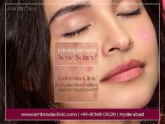 Looking for the best acne scar treatment in Hyderabad? Ambrosia Clinic offers advanced and personalized solutions to reduce acne scars, helping you achieve smooth and clear skin. Consult our expert dermatologists today to regain your confidence with effective scar removal treatments. https://maps.app.goo.gl/VY5cfQQxBAkmbjkD8
