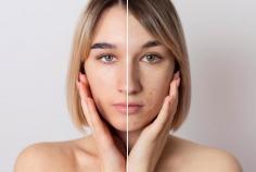 Want flawless skin? Learn about the best natural remedies to combat hyperpigmentation and restore your skin's natural glow.

Read More: https://tenaciousblog.com/hyperpigmentation-natural-remedies/
