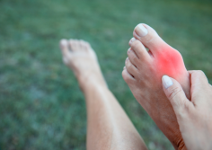 Preparing for bunion surgery? Discover essential recovery tips and timelines to help you heal effectively and regain your mobility with confidence!