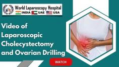 Focus on Laparoscopic Cholecystectomy and Ovarian Drilling The realm of surgical procedures is witnessing a transformative era with the adoption of minimally invasive techniques, significantly reducing recovery time and scarring for patients. Laparoscopic cholecystectomy and ovarian drilling are at the forefront of this transformative wave. This article explores the nuances and advantages of these procedures, with a special focus on a recent demonstration in Gurugram.

Go to the following this link: https://www.laparoscopyhospital.com/SERV01.HTM
