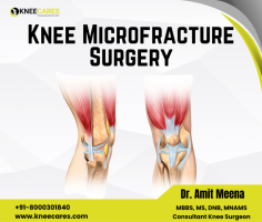 Are you struggling with persistent knee pain? Don't let it hold you back any longer. KneeCares specializes in Knee Microfracture Surgery, a minimally invasive procedure that can help restore your joint function and get you back on your feet.
