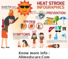 Know more about the heat stroke and prevention steps.