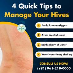 4 Tips to Manage Hives