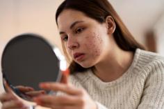 Dermatologist-approved skincare tips to help manage rosacea, focusing on gentle cleansing, hydration, and protection to calm sensitive skin.

Read More:  https://tenaciousblog.com/skincare-for-rosacea/ 
