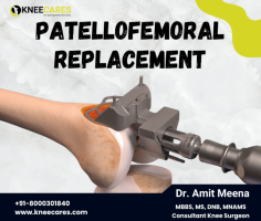 Choose the best knee treatment options for patellofemoral joint replacement in Jaipur. Our expert surgeons offer advanced revision knee replacement and knee arthroplasty, ensuring top-quality care and successful outcomes. Dr. Amit Meena and his team to restore full knee pain with our advanced techniques of knee surgery. Call now to schedule your consultation and take the first step toward a pain-free life!
