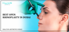 Looking for the best open rhinoplasty in Dubai? Halcyon Aesthetics offers top-tier nose reshaping and functional correction under Dr. OBT, an award-winning plastic surgeon. Achieve balanced, natural results at Dubai’s best rhinoplasty clinic. Learn more at Halcyon Aesthetics.