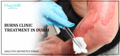 Halcyon Aesthetics Dubai provides the best burns clinic treatment in Dubai, specializing in burn surgery and reconstructive treatment. Led by Dr. OBT, a world-renowned burn surgeon and specialist doctor, we deliver top-tier burn care and aesthetic treatments in Dubai.