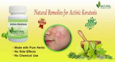 managing actinic keratosis through natural remedies and supplements can be an effective approach for those seeking alternatives to conventional treatments. Using ingredients such as apple cider vinegar, green tea, and coconut oil can help treat the condition while also supporting overall skin health.
https://www.naturalherbsclinic.com/blog/home-remedies-for-actinic-keratosis-healing-with-natural-treatments/
