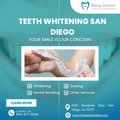 Get a brighter, more confident smile with professional teeth whitening in San Diego at Mesa Dental. Our expert team uses advanced techniques to remove stains and discoloration, helping you achieve noticeable results. Schedule your teeth whitening session today and enjoy a radiant smile.