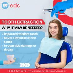 Tooth Extraction | Emergency Dental Service

Tooth extraction is a dental procedure that is necessary due to various factors, such as impacted wisdom teeth, severe infections, or irreparable damage. It involves the careful removal of a tooth from its socket in the jawbone. Emergency Dental Service offers quick tooth extraction solutions to relieve pain and restore your comfort and smile. Schedule an appointment at 1-888-350-1340.