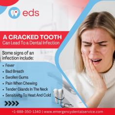 A Cracked Tooth | Emergency Dental Service

A cracked tooth can lead to dental infection, which can cause fever, bad breath, swollen gums, pain when chewing, tender glands in the neck, and sensitivity to heat and cold. It's essential to be aware of these symptoms and get dental care quickly if you experience them. Schedule an appointment at 1-888-350-1340. 