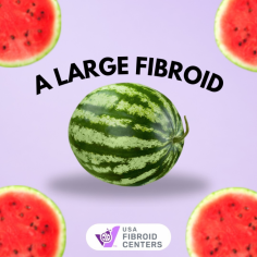 Why UFE Fibroids Treatment Works for Large Fibroids
If you're dealing with large fibroids and seeking a non-surgical solution, Uterine Fibroid Embolization (UFE) could be the answer. UFE is an advanced, minimally invasive procedure that targets fibroids of all sizes, including large ones. By shrinking fibroids through reduced blood flow, UFE offers relief from symptoms like heavy bleeding, pain, and pressure. Many women prefer UFE because it preserves the uterus, allowing them to avoid the risks and recovery time associated with surgery.
At USA Fibroid Centers, our specialists use cutting-edge techniques to deliver personalized care, ensuring that UFE fibroid treatment is safe and effective. Don’t let large fibroids dictate your life—explore UFE as a viable option for long-lasting relief.
Visit- https://www.usafibroidcenters.com/blog/does-ufe-work-on-large-fibroids/ 