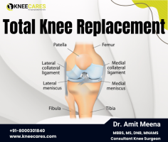 Looking for Total Knee Replacement issues? Visit us in Jaipur for world-class treatment for knee arthroplasty, knee cartilage surgery, and osteoarthritis. Our specialists from Europe and North America, Dr. Amit Meena, are committed to providing best knee treatments.
