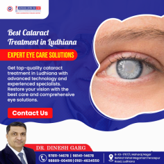 Get top-quality cataract treatment in Ludhiana with advanced technology and experienced specialists. Restore your vision with the best care and comprehensive eye solutions. 
Visit: https://advancedcentreforeyes.in/cataract/
