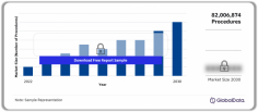 EU5 Anesthesia Device Procedures Count and Forecast to 2030

The total count of anesthesia device procedures performed in EU5 was 82,006,874 in 2022. Anesthesia procedures include procedures that involve devices used in conjunction with the anesthesia equipment to administer anesthesia.

For more details visit: https://www.globaldata.com/store/report/eu5-anesthesia-device-procedures-market-analysis/