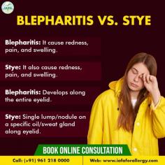 Differences Between Blepharitis and Stye