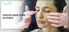 Get even-toned, smooth skin with the top uneven skin tone treatment in Dubai. Halcyon Aesthetics, under Dr. OBT, offers expert skin toning and customized skincare solutions.